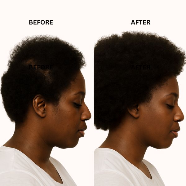 Before and after comparison of a WOMANS hair on a white background